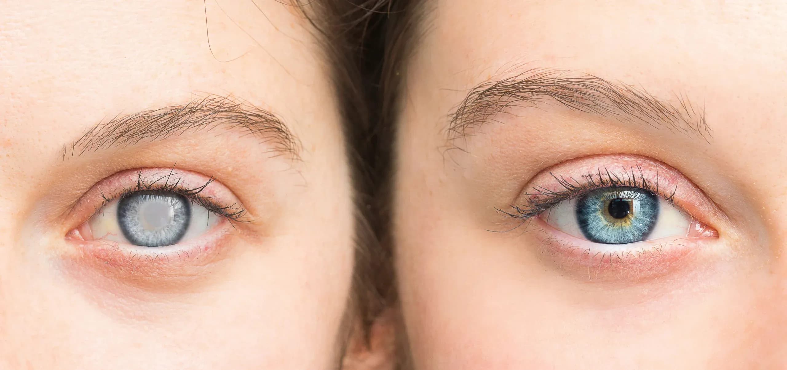 Are you facing difficulty detecting movement or changes in your side vision?